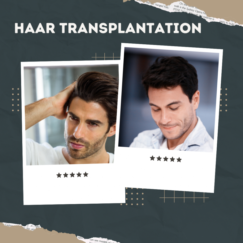 Haartransplantation